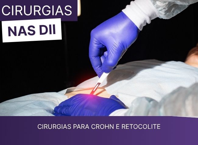 Cirurgias para Crohn e Retocolite