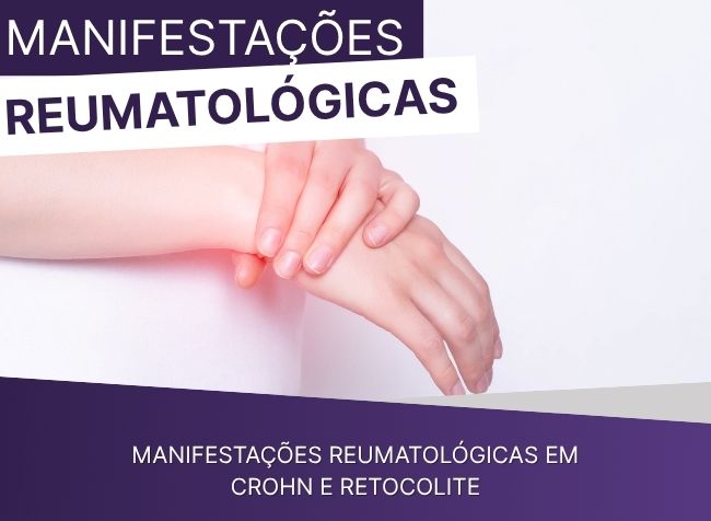 Manifestações reumatológicas em Crohn e Retocolite