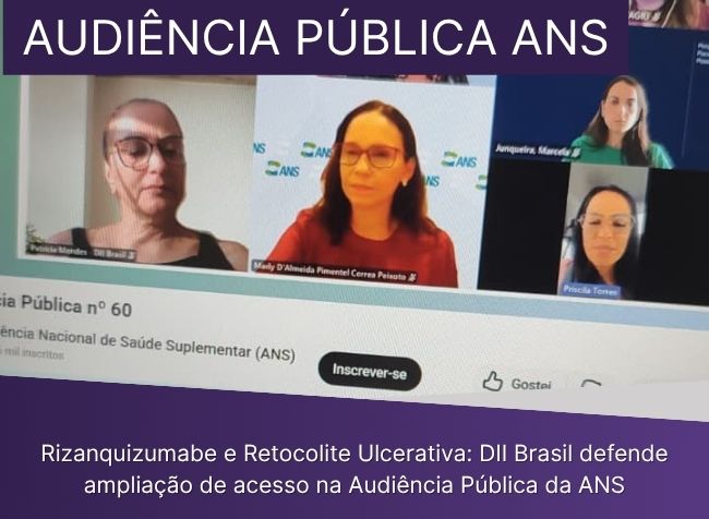 Rizanquizumabe e Retocolite Ulcerativa: DII Brasil defende ampliação de acesso na Audiência Pública da ANS
